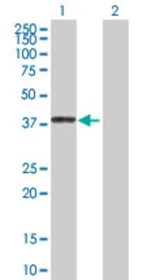 Western Blot: ACK1 Antibody [H00010188-D01P]