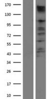 Western Blot: ACK1 Overexpression Lysate [NBP2-10443]