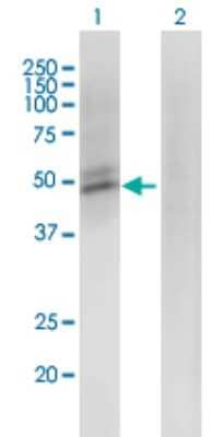 Western Blot: ACMSD Antibody (3A9) [H00130013-M01]