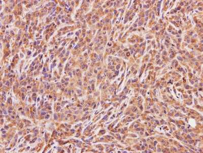Immunohistochemistry-Paraffin: ACMSD Antibody [NBP1-33499]