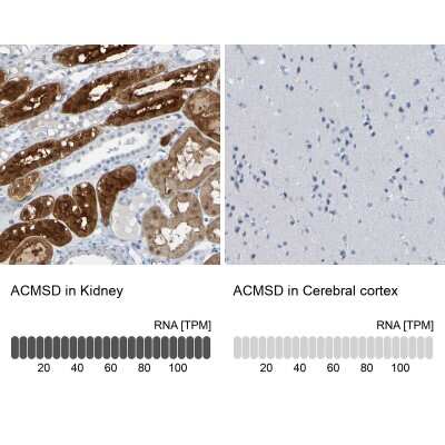 Immunohistochemistry-Paraffin: ACMSD Antibody [NBP1-86108]