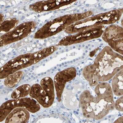 Immunohistochemistry-Paraffin: ACMSD Antibody [NBP1-86108]