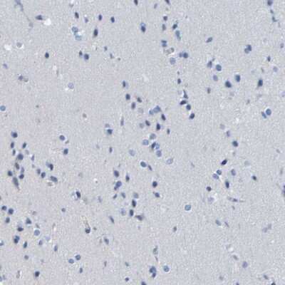 Immunohistochemistry-Paraffin: ACMSD Antibody [NBP1-86108]