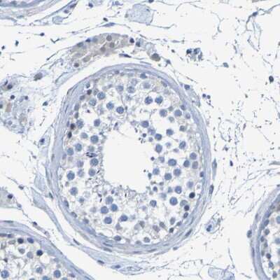 Immunohistochemistry-Paraffin: ACMSD Antibody [NBP1-86108]