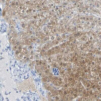 Immunohistochemistry-Paraffin: ACMSD Antibody [NBP1-86108]