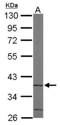 Western Blot: ACMSD Antibody [NBP1-33499]