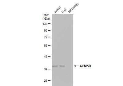 Western Blot: ACMSD Antibody [NBP1-33499]