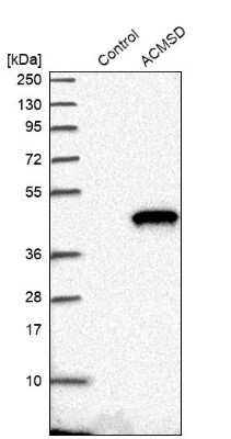 Western Blot: ACMSD Antibody [NBP1-86480]