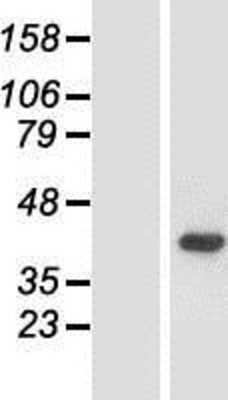 Western Blot: ACMSD Overexpression Lysate [NBP2-05677]