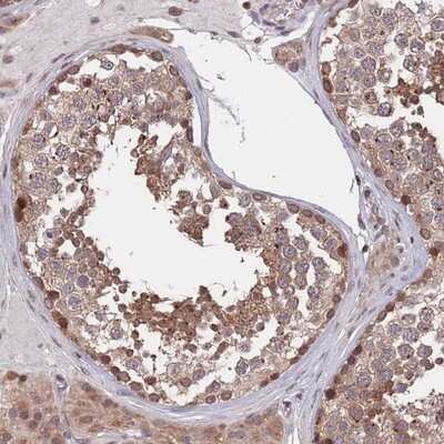 Immunohistochemistry-Paraffin: ACN9 Antibody [NBP2-14259]