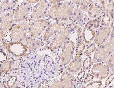 Immunohistochemistry-Paraffin: ACN9 Antibody [NBP3-06162]