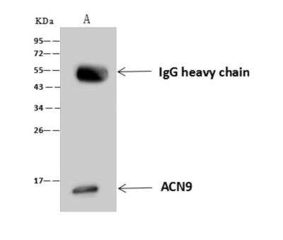 Immunoprecipitation: ACN9 Antibody [NBP3-06162]