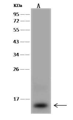 Western Blot: ACN9 Antibody [NBP3-06162]