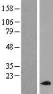 Western Blot: ACN9 Overexpression Lysate [NBL1-07242]