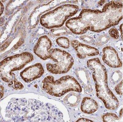 Immunohistochemistry-Paraffin: ACOT1 Antibody [NBP2-54709]