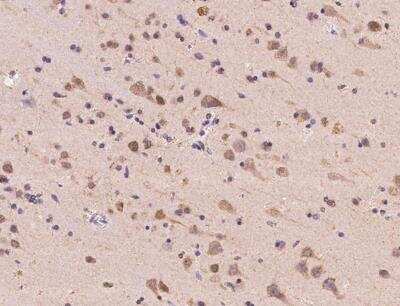 Immunohistochemistry-Paraffin: ACOT1 Antibody [NBP3-12713]