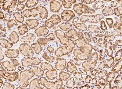 Immunohistochemistry-Paraffin: ACOT1 Antibody [NBP3-12713]
