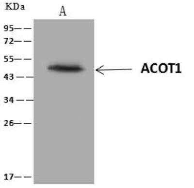 Immunoprecipitation: ACOT1 Antibody [NBP3-12713]