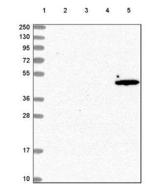 Western Blot: ACOT1 Antibody [NBP2-54709]