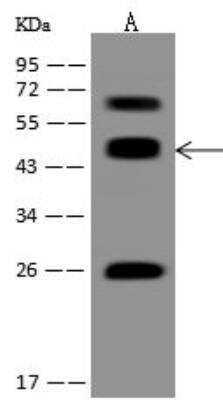 Western Blot: ACOT1 Antibody [NBP3-12713]