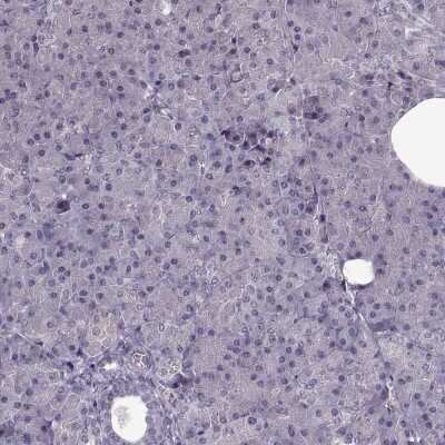 Immunohistochemistry-Paraffin: ACOT11 Antibody [NBP2-58936]
