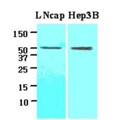 Western Blot: ACOT11 Antibody (J4B2)BSA Free [NBP1-04289]