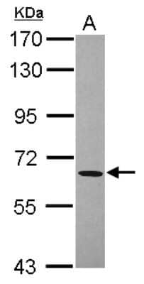 Western Blot: ACOT11 Antibody [NBP2-15246]