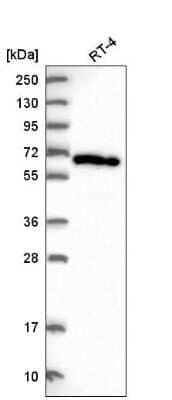 Western Blot: ACOT11 Antibody [NBP2-58936]