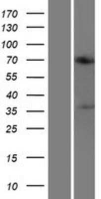 Western Blot: ACOT11 Overexpression Lysate [NBP2-07148]