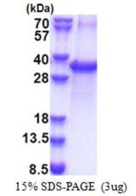 SDS-PAGE: Recombinant Human ACOT11 His Protein [NBP2-22675]