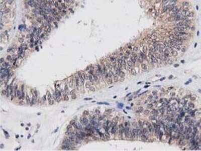 Immunohistochemistry-Paraffin: ACOT12 Antibody (OTI1A11) [NBP2-03605]
