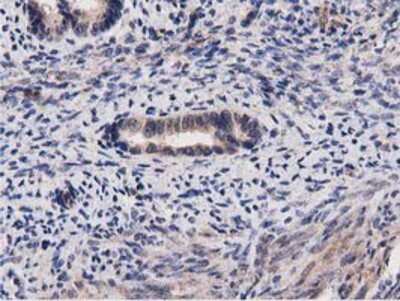 Immunohistochemistry-Paraffin: ACOT12 Antibody (OTI1A11) [NBP2-03605]