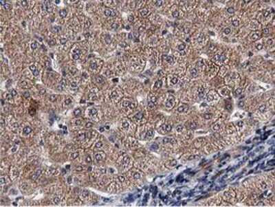 Immunohistochemistry-Paraffin: ACOT12 Antibody (OTI1A11) [NBP2-03605]