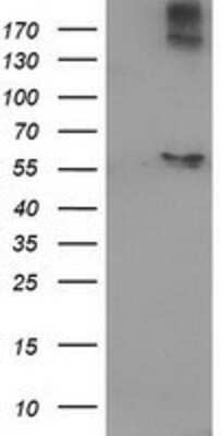 Western Blot: ACOT12 Antibody (OTI1A11) [NBP2-03605]