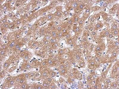 Immunohistochemistry-Paraffin: ACOT12 Antibody [NBP2-15247]