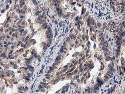 Immunohistochemistry: ACOT12 Antibody (OTI1A11) - Azide and BSA Free [NBP2-72389]