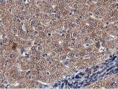 Immunohistochemistry: ACOT12 Antibody (OTI1A11) - Azide and BSA Free [NBP2-72389]