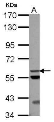 Western Blot: ACOT12 Antibody [NBP2-15247]