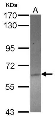 Western Blot: ACOT12 Antibody [NBP2-15248]