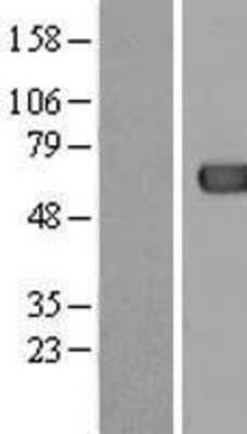 Western Blot: ACOT12 Overexpression Lysate [NBL1-07247]