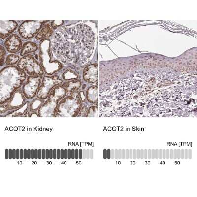 Immunohistochemistry-Paraffin: ACOT2 Antibody [NBP2-62632]