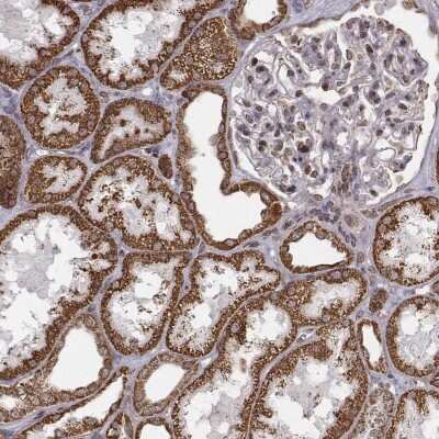 Immunohistochemistry-Paraffin: ACOT2 Antibody [NBP2-62632]