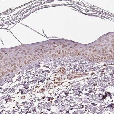 Immunohistochemistry-Paraffin: ACOT2 Antibody [NBP2-62632]
