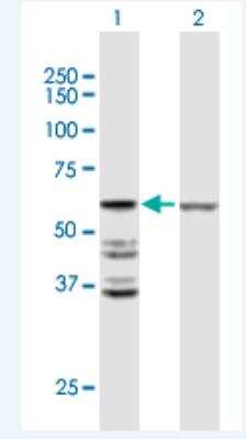 Western Blot: ACOT2 Antibody [H00010965-B01P-50ug]