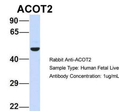 Western Blot: ACOT2 Antibody [NBP1-70402]