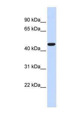 Western Blot: ACOT2 Antibody [NBP1-70402]