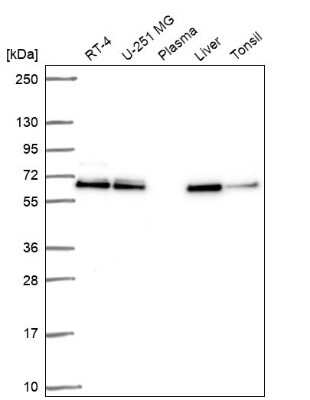 Western Blot: ACOT2 Antibody [NBP2-62632]