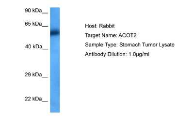 Western Blot: ACOT2 Antibody [NBP2-86947]