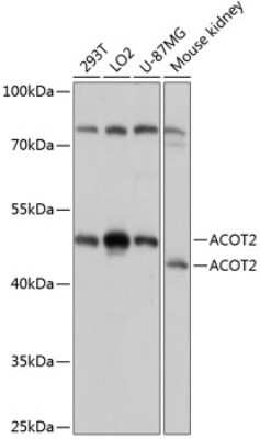 Western Blot: ACOT2 AntibodyAzide and BSA Free [NBP2-92161]