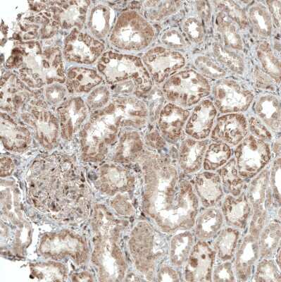 Immunohistochemistry-Paraffin: ACOT4 Antibody [NBP1-83539]